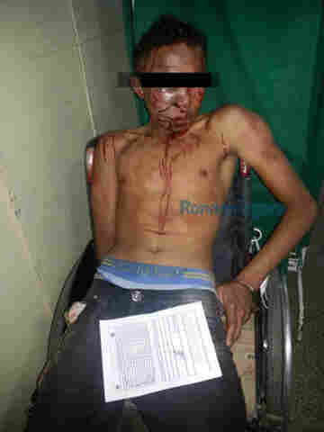 CRIMINOSO SE DÁ MAL E POR POUCO NÃO É MORTO APÓS ASSALTO NA CAPITAL