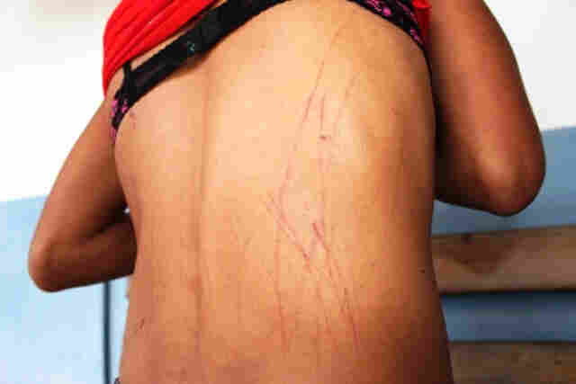 Mulher era obrigada a se vestir como homem e apanhava todos os dias do marido