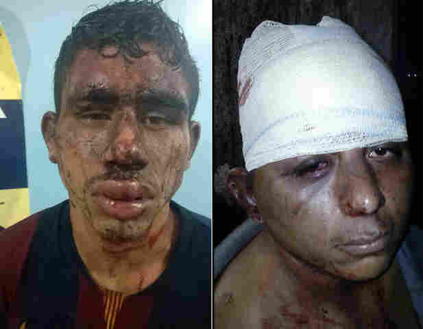 DUPLA É DETIDA E AGREDIDA POR POPULARES APÓS TENTAR ROUBAR CASA