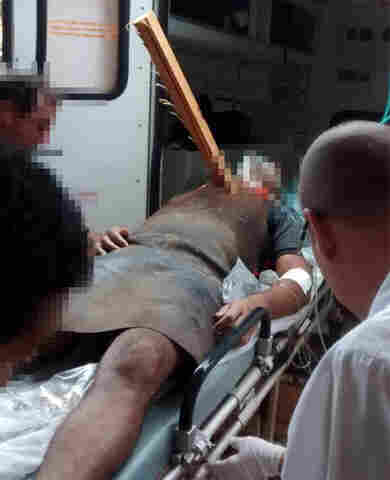 JOVEM GRAVEMENTE FERIDO COM PEDAÇO DE MADEIRA NA GARGANTA