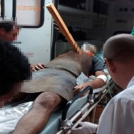 JOVEM GRAVEMENTE FERIDO COM PEDAÇO DE MADEIRA NA GARGANTA