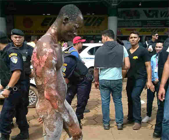 MORRE HOMEM QUE TEVE CORPO INCENDIADO NA RODOVIÁRIA