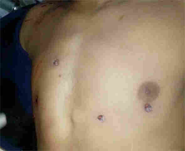 Desconhecidos &#101;xecutam ex-presidiário em Bairro da Zona Leste