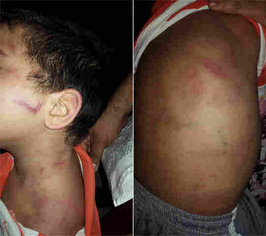 MULHER É PRESA POR TORTURAR SOBRINHO DE 4 ANOS