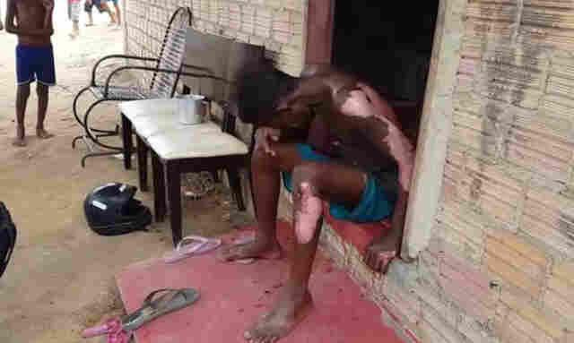 HOMEM TEM O CORPO QUEIMADO E CASA DESTRUÍDA APÓS EXPLOSÃO DE PANELA DE PRESSÃO