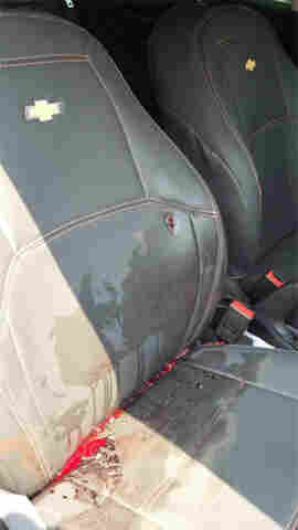 Jovem atingido por tiro de fuzil em Porto Velho