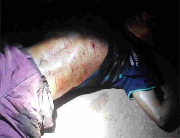 CRIMINOSO MORRE APÓS SER ESPANCADO POR POPULARES NA CAPITAL