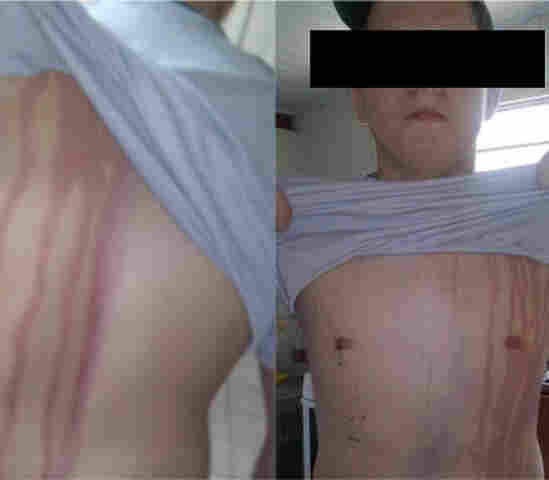 Trote violento manda universitários para o Hospital