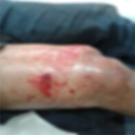 Ladrões tentam roubar dinamite em pedreira de Ouro Preto; vigia é baleado