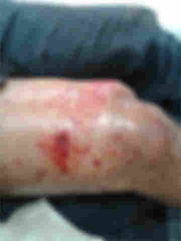 Ladrões tentam roubar dinamite em pedreira de Ouro Preto; vigia é baleado