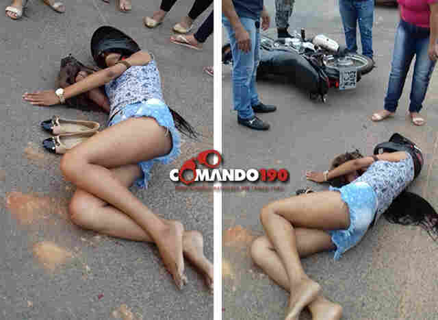 Motociclista sofre fratura exposta em mais um acidente de trânsito