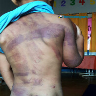 Mãe e padrasto espancam criança de 4 anos e são presos