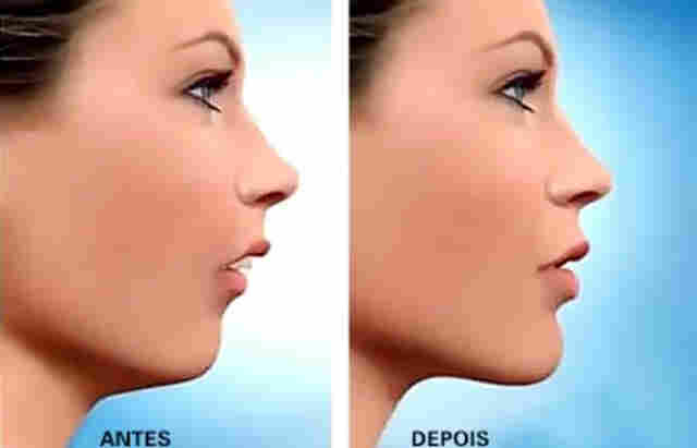 Por ano, Hospital de Base corrige mais de 200 faces de vítimas de traumatismo