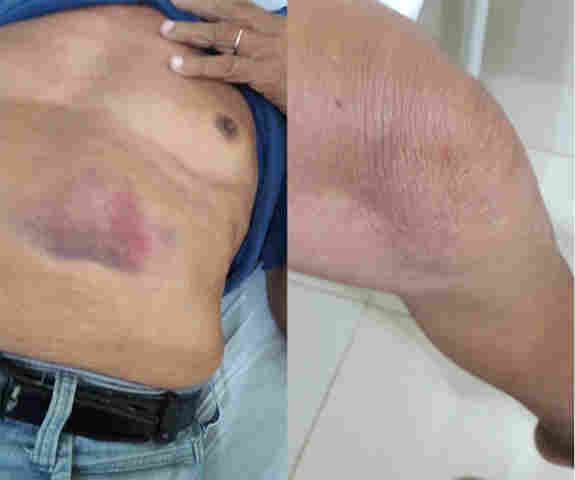 Idoso de 82 anos é espancado e suspeito acaba preso