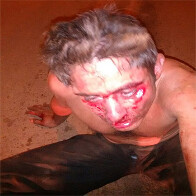 Populares surram criminoso que tentou roubar motociclista em Porto Velho