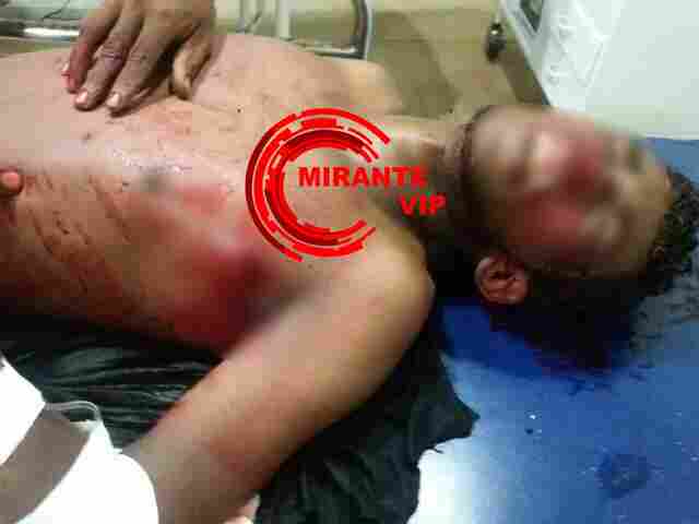 Jovem é baleado enquanto caminhava pela rua