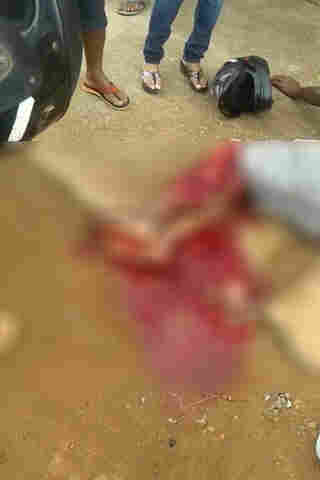 Idoso tem a perna dilacerada em acidente na Zona Leste