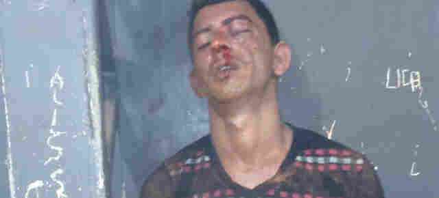 Jovem de 23 anos é linchado e recusa atendimento médico por medo de agulha