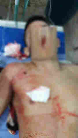 Jovem sofre tentativa de homicídio em frente a residência