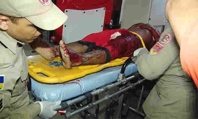 Homem é espancado por populares e preso após esfaquear desafeto em bar