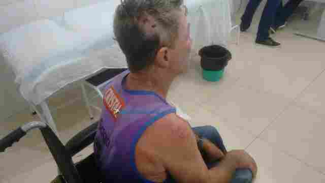 Agricultor é agredido a pauladas por desconhecidos em Ouro Preto do Oeste