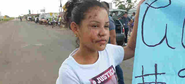 Após sobreviver a acidente que matou amiga, adolescente pede mais sinalização. “É revoltante”