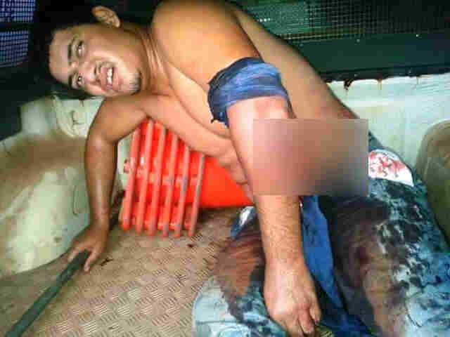 Dupla troca tiros com a PM após roubar carro e um bandido é baleado no braço