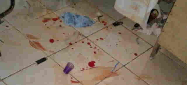 Mulher é esfaqueada pelo ex-marido em apartamento