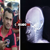 Homem é baleado na cabeça ao chegar em casa