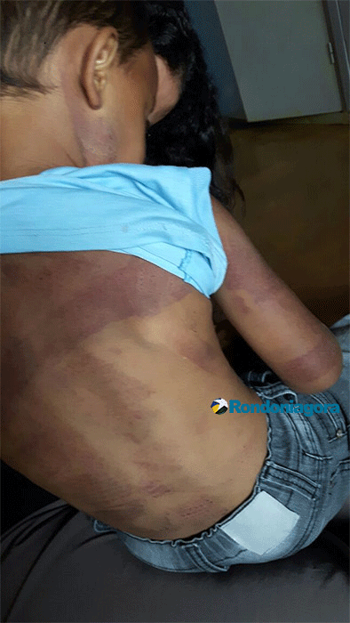 Justiça manda soltar casal que espancou criança de 4 anos e classifica crime como maus tratos