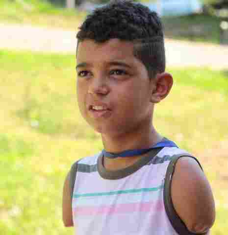 Sem os braços, paratleta opta pelo atletismo na busca de classificação nos Jogos Paralímpicos Escolares