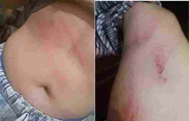 Em rede social, internauta denuncia agressão de pai em adolescente e imagens geram revolta