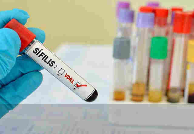 Porto Velho registra 70 casos de bebês infectados por sífilis congênita neste ano, informa Semusa