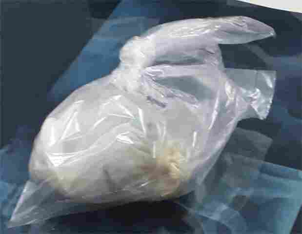 Detento é preso com drogas no ânus