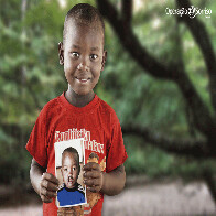 Operação Sorriso seleciona pacientes com fissura labiopalatina para mutirão de cirurgias em Porto Velho