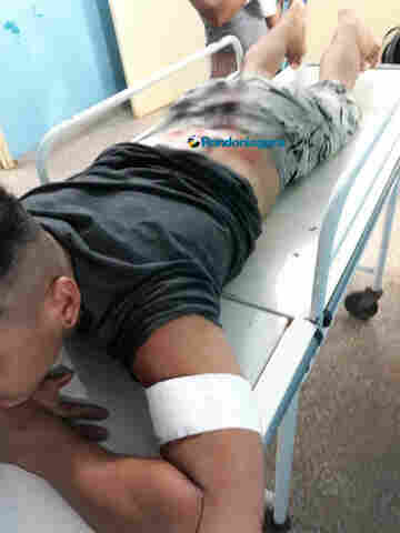 Jovem é esfaqueado na Zona Leste de porto velho