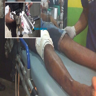 Durante assalto a residência, criminoso troca tiros com a PM e é baleado na perna