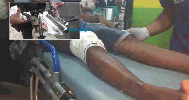 Durante assalto a residência, criminoso troca tiros com a PM e é baleado na perna