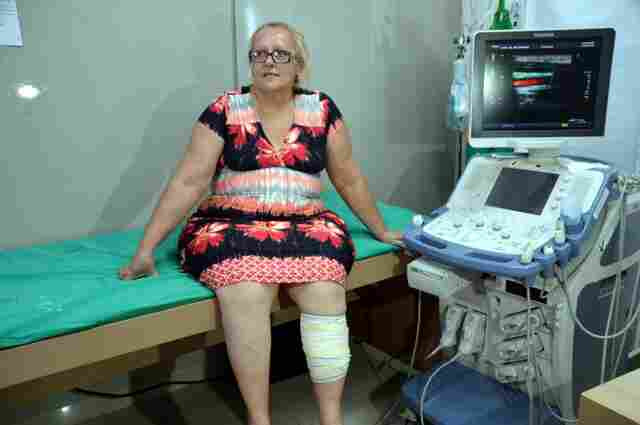 Técnica de tratamento de varizes com espuma já atendeu 360 pacientes no Hospital de Base