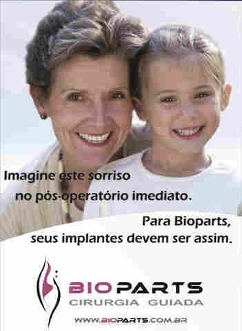 Clínica Estilo realiza procedimento de implantes sem corte e sem pontos em Porto Velho