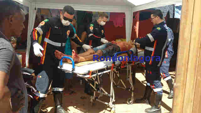 Jovem é atingido com tiro de chumbeira durante bebedeira em Porto Velho