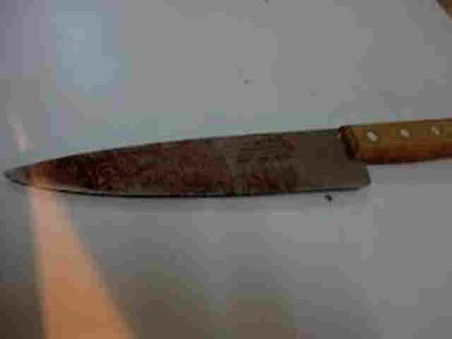 Homem esfaqueado pelo irmão morre por complicações após receber alta