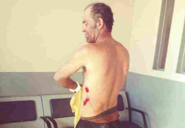 Homem é baleado pela polícia ao ser flagrado esfaqueando a esposa