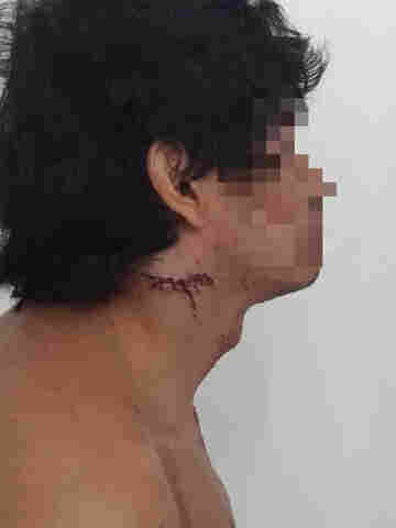 Incentivado pelo companheiro, alvo de operação da PF contra pornografia infantil tenta se matar