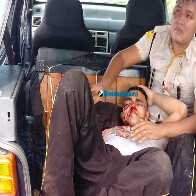 Fotos e vídeo: bando tenta assaltar carro forte, incendeia veículo e fere segurança na BR-319