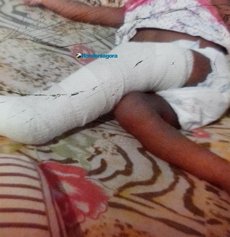 Monitorado por tornozeleira é preso com 7 Kg de maconha após fraturar perna da própria filha de 1 ano