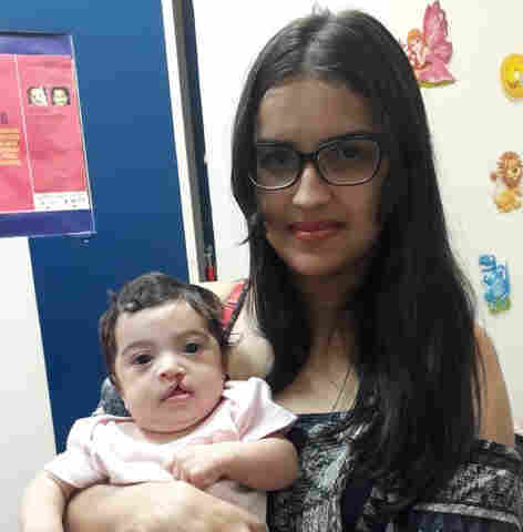 Cirurgias para correção de lábio leporino estão sendo realizadas no Hospital de Base em Porto Velho