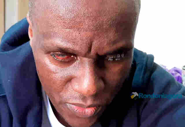 Vídeo: Médico atacado por agente penitenciário está cego e diz ter medo de voltar a Rondônia e ser morto