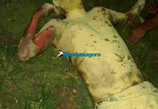 Morre homem que teve o corpo queimado durante incêndio em residência