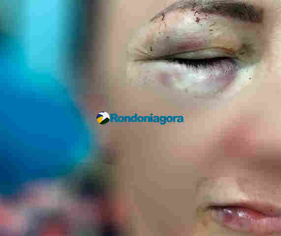 Mulher é espancada pelo filho dentro de carro em Porto Velho